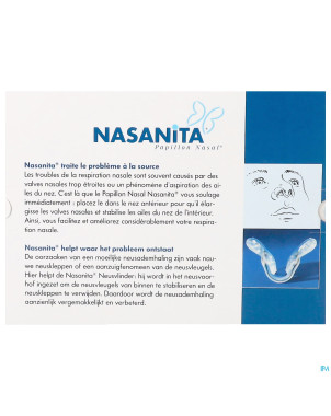 Nasanita papillon nasal 1