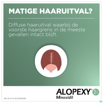 Alopexy 2 % liquid fl pipette/spray 3x60ml