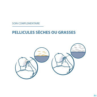 Ducray squanorm lotion a/pellicul. zinc 200ml