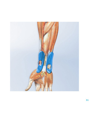 Manutrain poignet titan droit t5