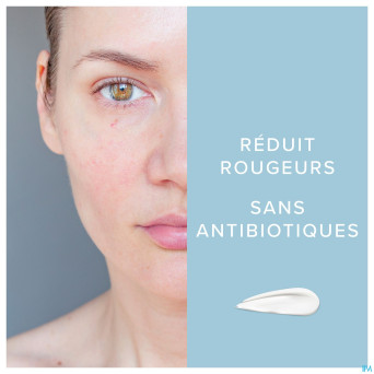 Dermalex creme a/rougeurs 30g