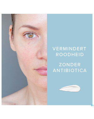 Dermalex creme a/rougeurs 30g