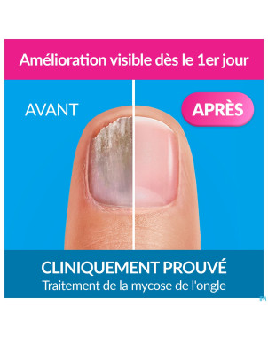 Excilor forte mycose des ongles 30ml