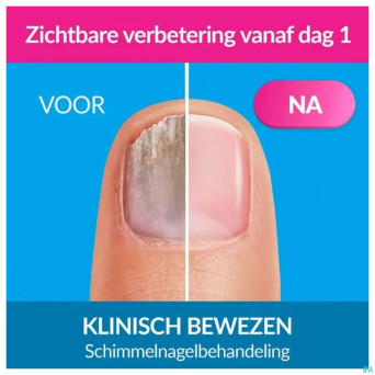 Excilor forte mycose des ongles 30ml