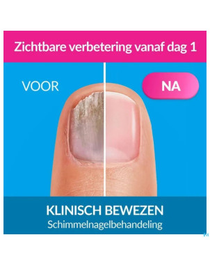 Excilor forte mycose des ongles 30ml