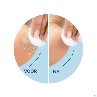 Scholl velvet smooth rape electr.+gommage ps bleu