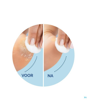 Scholl velvet smooth rape electr.+gommage ps bleu