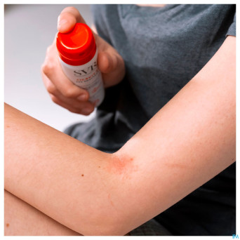 Svr cicavit a/grattage spray 40ml