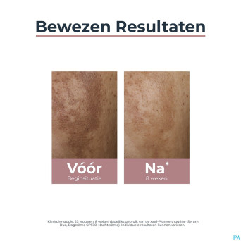 Eucerin a/pigment double serum 30ml