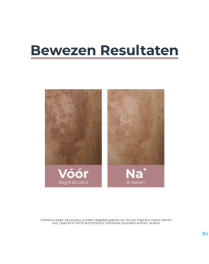 Eucerin a/pigment double serum 30ml