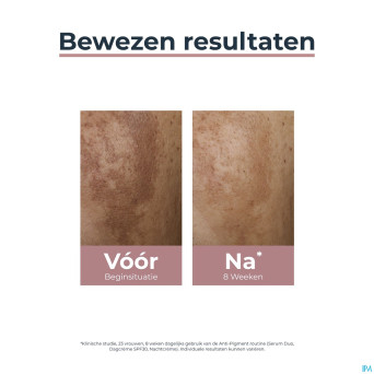 Eucerin a/pigment soin nuit    50ml