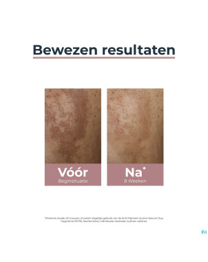 Eucerin a/pigment soin nuit    50ml