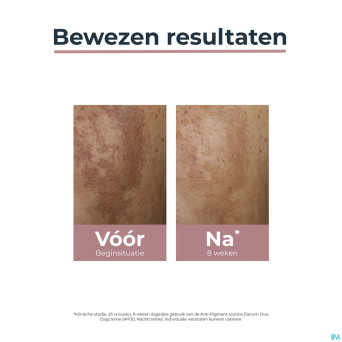 Eucerin a/pigment soin jour ip30    50ml