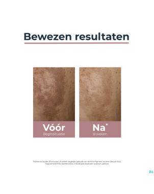 Eucerin a/pigment soin jour ip30    50ml