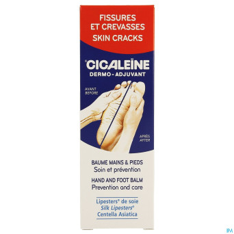 Akileine cicaleine    tube 50ml