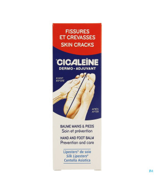 Akileine cicaleine    tube 50ml
