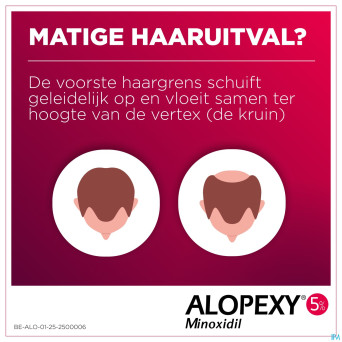 Alopexy 50mg/ml sol application cutanee fl 3x60ml