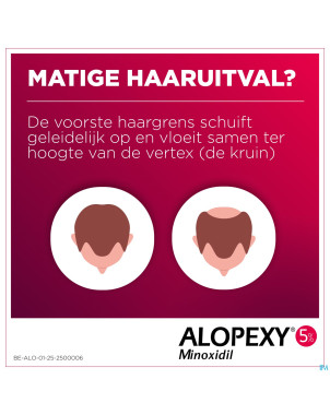 Alopexy 50mg/ml sol application cutanee fl 3x60ml