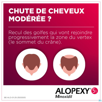 Alopexy 50mg/ml sol application cutanee fl 3x60ml