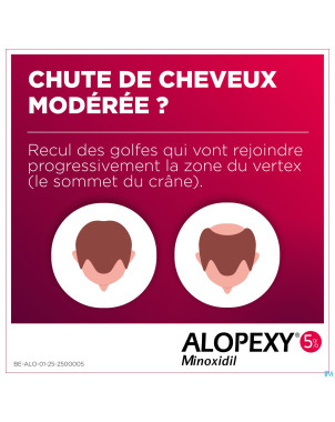 Alopexy 50mg/ml sol appl cut.fl pipette/spray 60ml