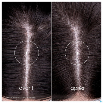 Klorane capil. sh ortie    400ml nf