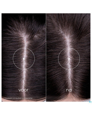 Klorane capil. sh ortie    200ml nf