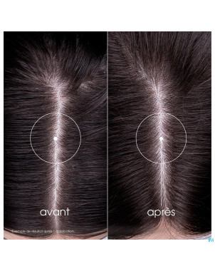 Klorane capil. sh ortie    200ml nf