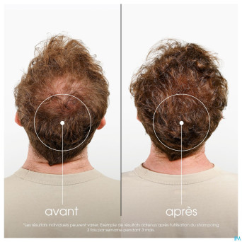 Klorane capil. sh quinine 100ml