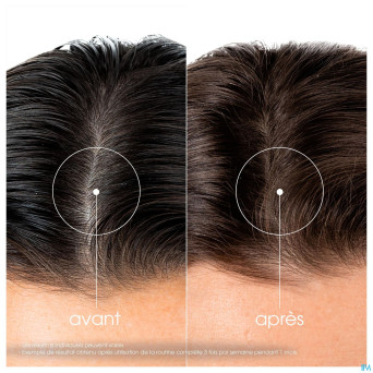 Klorane capil. sh quinine 100ml