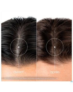 Klorane capil. sh quinine & edelweiss 400ml    nf