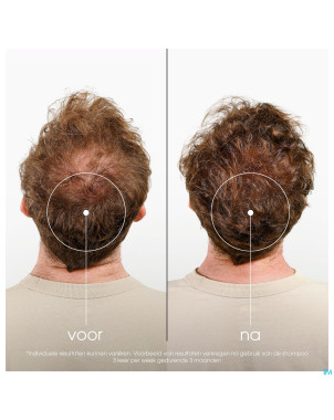 Klorane capil. sh quinine & edelweiss 400ml    nf