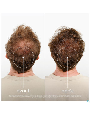 Klorane capil. sh quinine & edelweiss 400ml    nf