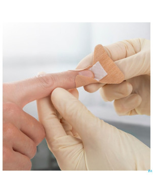 Leukoplast elastic 19x75mm    100