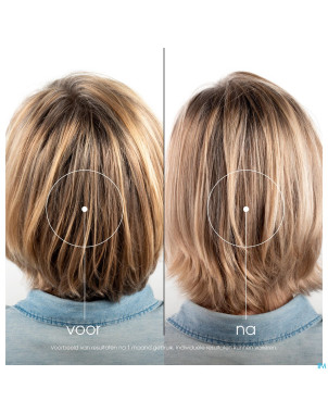 Klorane capil. baume centauree    200ml