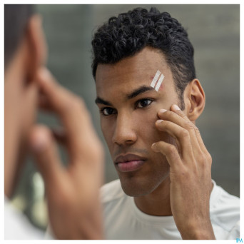 Steri-strip 3m suture cutan. adh assortiment  8