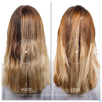 Klorane capil. ap/sh lin 200ml