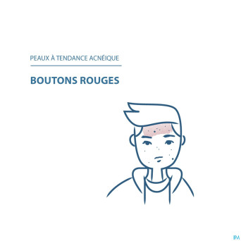 Ducray keracnyl pp+ creme 30ml