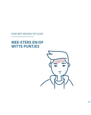 Ducray keracnyl glycolic+ creme desincrustant 30ml