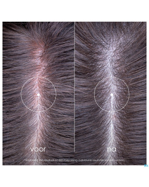 Klorane capil. sh pivoine bio 200ml