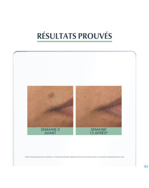 Eucerin dermopure serum triple action    40ml