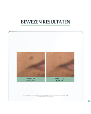 Eucerin dermopure serum triple action    40ml