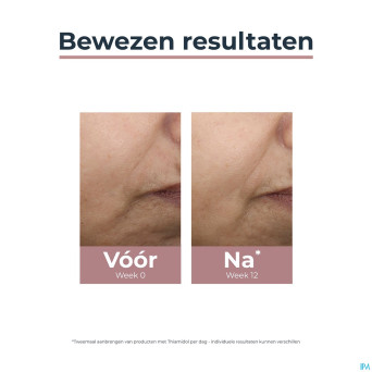 Eucerin a/pigment soin jour teinte ip30 medium50ml