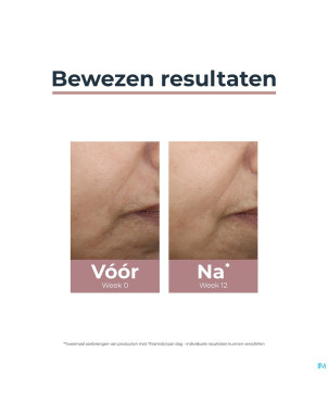 Eucerin a/pigment soin jour teinte ip30 medium50ml