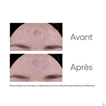 Aderma biology ac global soin a/imperfections 40ml