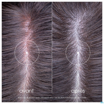 Klorane capil. sh pivoine bio 100ml