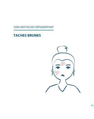 Ducray melascreen concentre a/taches    30ml