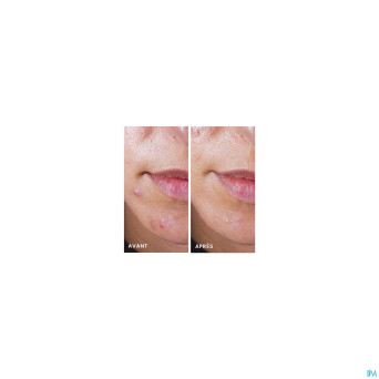 Avene cleanance comedomed repack 30ml