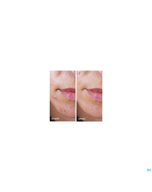 Avene cleanance comedomed repack 30ml