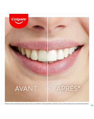 Colgate max white kit blancheur led    2 prod.