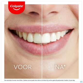 Colgate max white kit blancheur led    2 prod.